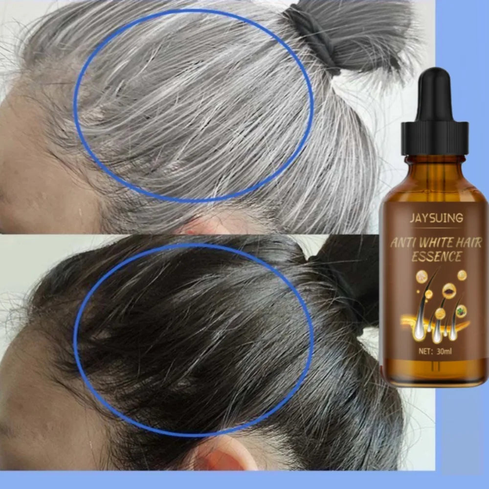 Esencia Anti-Cabello Blanco: Revitaliza y Estimula el Crecimiento Capilar - Automaticprime
